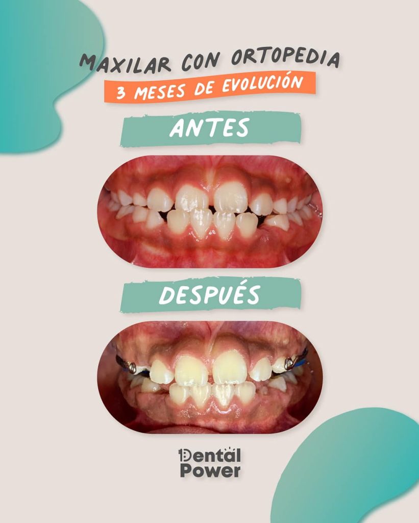 GALERIA ANTES DESPUES 1