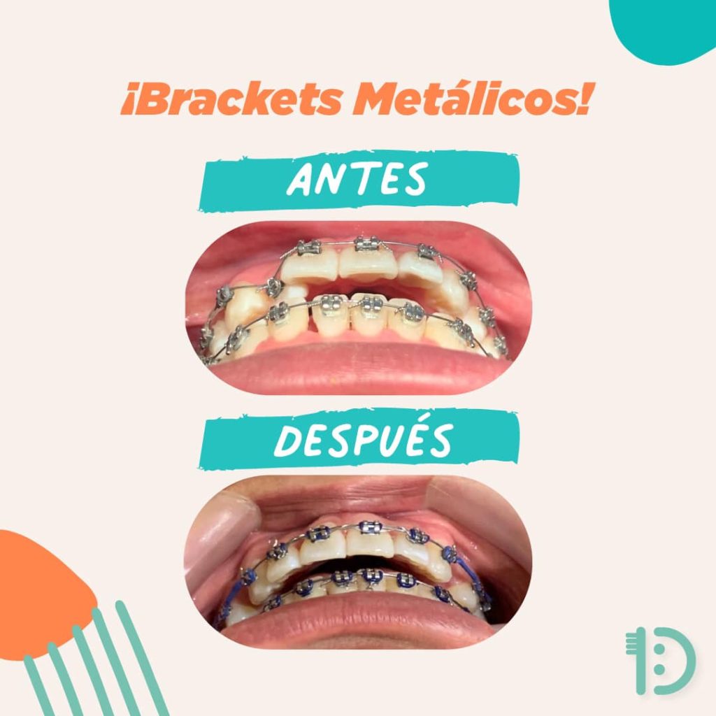GALERIA ANTES DESPUES 3