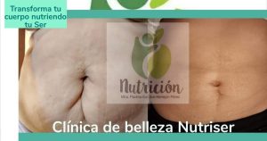 Galería Nutriser 2