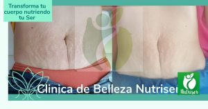 Galería Nutriser 3