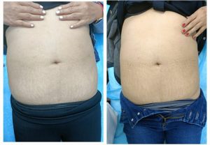 WhatsApp Image 2025-07-16 at 1.25.28 PM