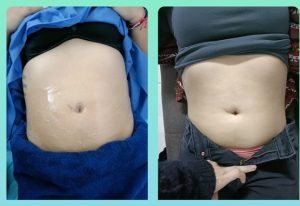 WhatsApp Image 2025-07-16 at 1.25.44 PM