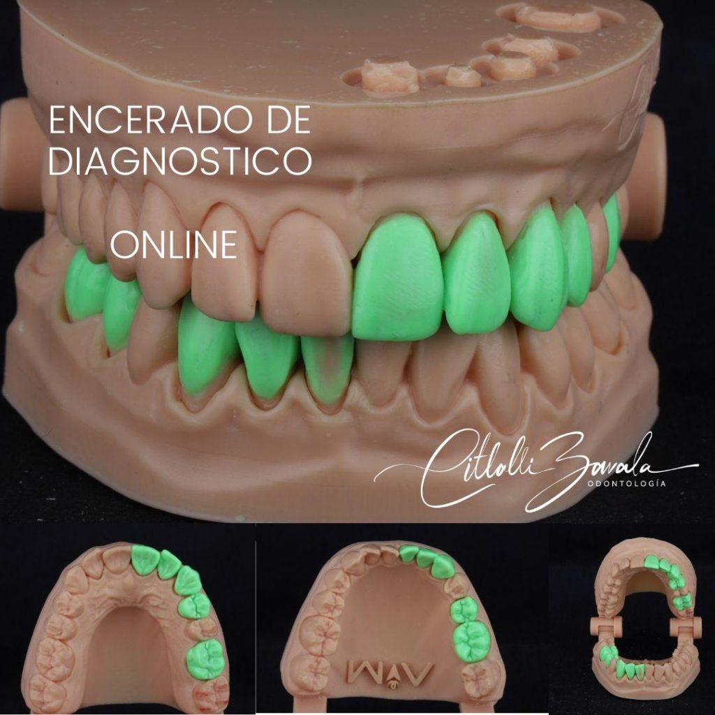 CURSO Encerado de Diagnóstico Online